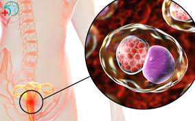 Vai trò của bổ sung vitamin và sắt trong điều trị viêm nhiễm phụ khoa khi mang thai